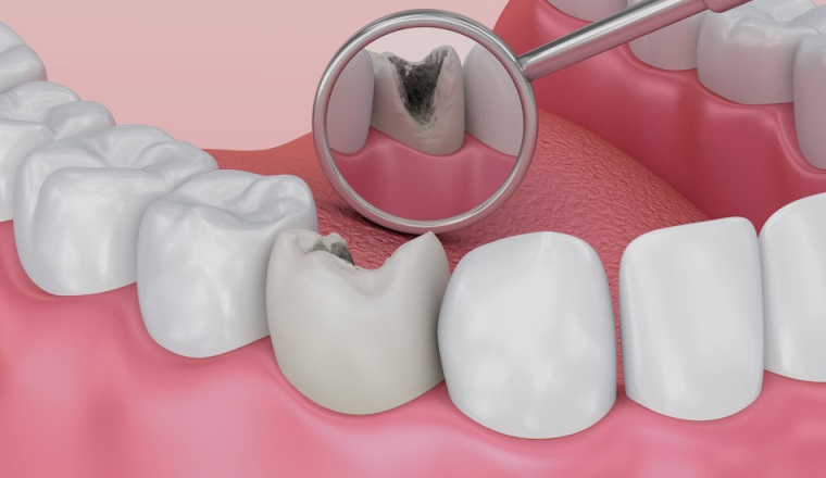 Diş Tedavileri Sağlık Hizmetleri (SGK)